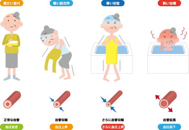 住宅の寒さ